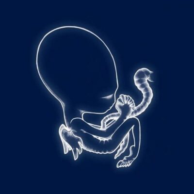 シガー・ロス(Sigur Ros)おすすめ名盤『Agaetis Byrjun』レビュー｜アイスランドから響く天上のポストロック——転調に頼らず感情を揺さぶる仕掛けとは